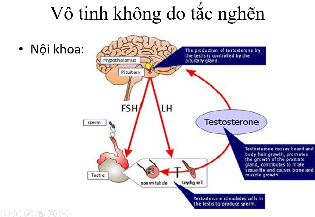 VÔ SINH DO KHÔNG CÓ TINH TRÙNG